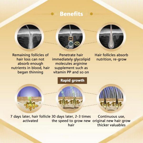 Natural Hair Growth Serum Essence - Exinoz