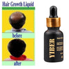 Natural Hair Growth Serum Essence - Exinoz