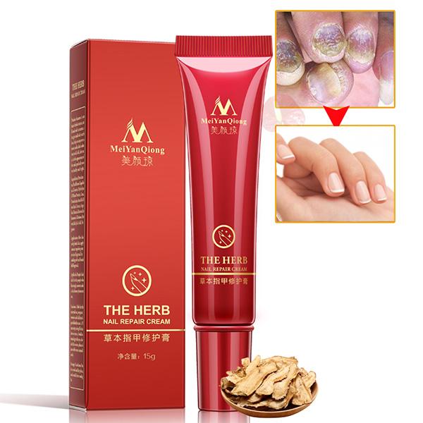 NAIL TREATMENT CREAM - Exinoz