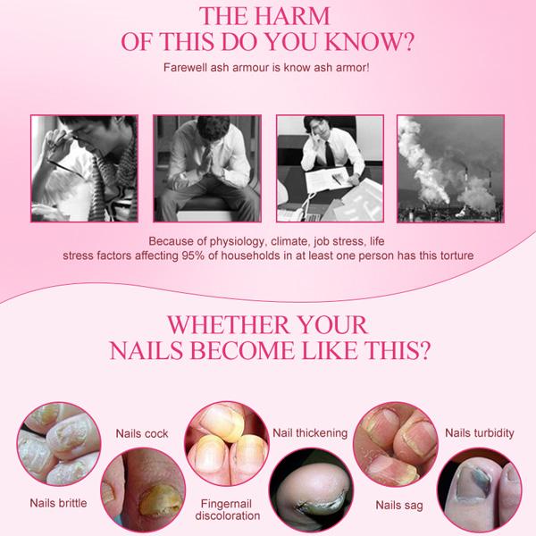 NAIL TREATMENT CREAM - Exinoz