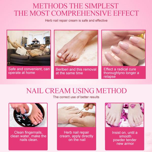 NAIL TREATMENT CREAM - Exinoz